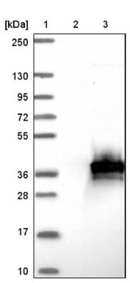 Western Blot: HLRC1 Antibody [NBP1-91994] - Lane 1: Marker [kDa] 250, 130, 95, 72, 55, 36, 28, 17, 10<br/>Lane 2: Negative control (vector only transfected HEK293T lysate)<br/>Lane 3: Over-expression lysate (Co-expressed with a C-terminal myc-DDK tag (~3.1 kDa) in mammalian HEK293T cells, LY428737)