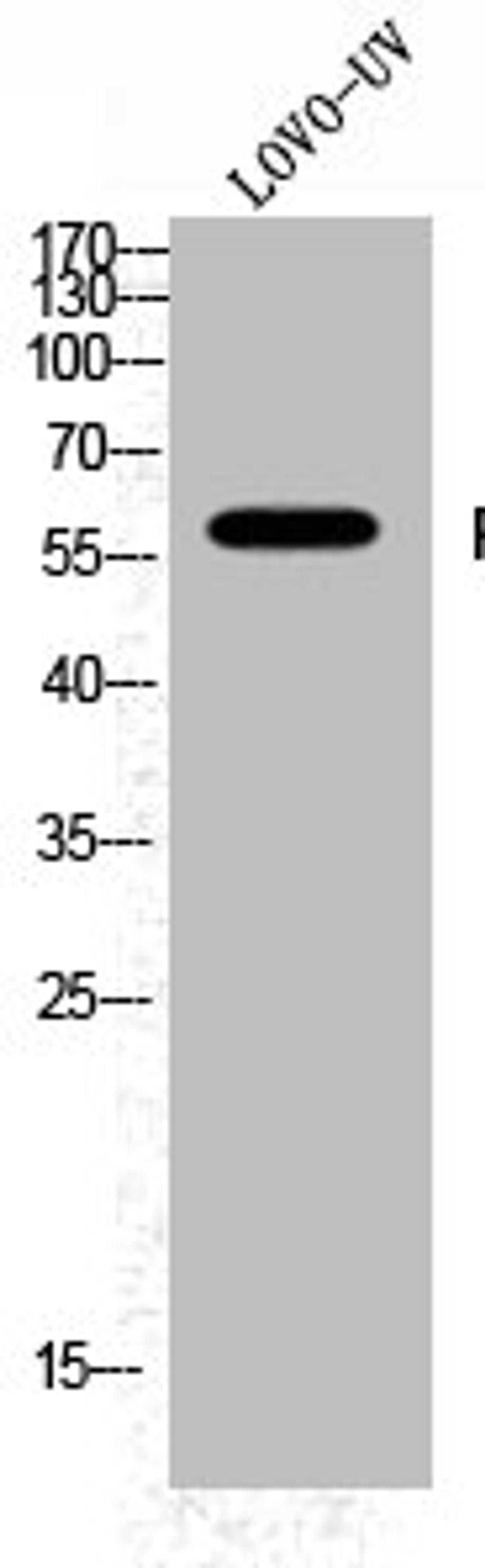 Western Blot analysis of LOVO+UV cells using Phospho-Fyn (Y530) Polyclonal Antibody
