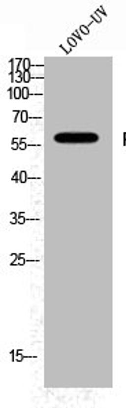 Western Blot analysis of LOVO+UV cells using Phospho-Fyn (Y530) Polyclonal Antibody