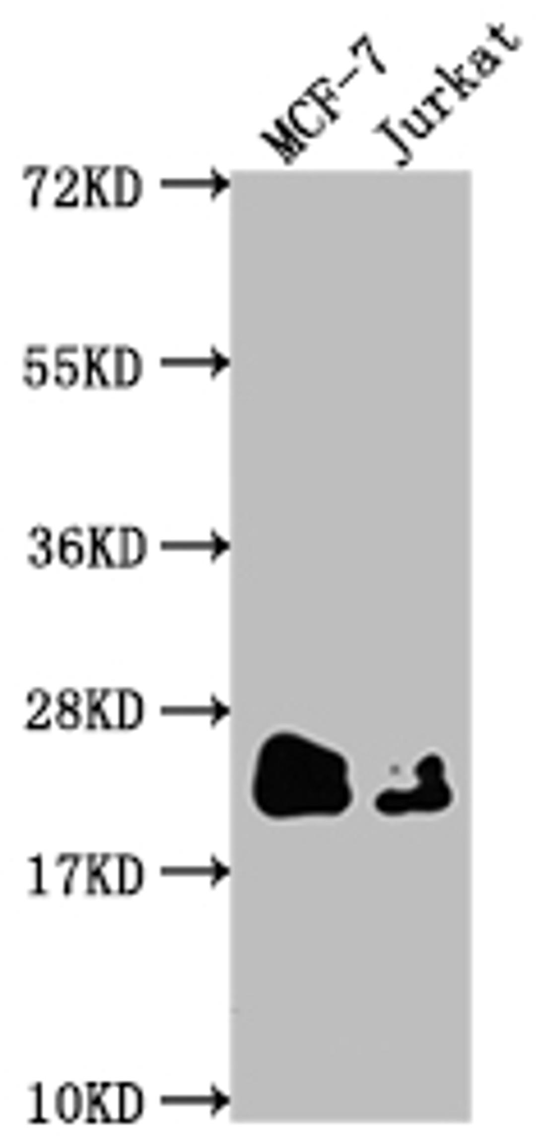 Western Blot. Positive WB detected in: MCF-7 whole cell lysate, Jurkat whole cell lysate. All lanes: MGMT antibody at 1:1500. Secondary. Goat polyclonal to rabbit IgG at 1/50000 dilution. Predicted band size: 22 kDa. Observed band size: 22 kDa. 