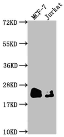 Western Blot. Positive WB detected in: MCF-7 whole cell lysate, Jurkat whole cell lysate. All lanes: MGMT antibody at 1:1500. Secondary. Goat polyclonal to rabbit IgG at 1/50000 dilution. Predicted band size: 22 kDa. Observed band size: 22 kDa. 
