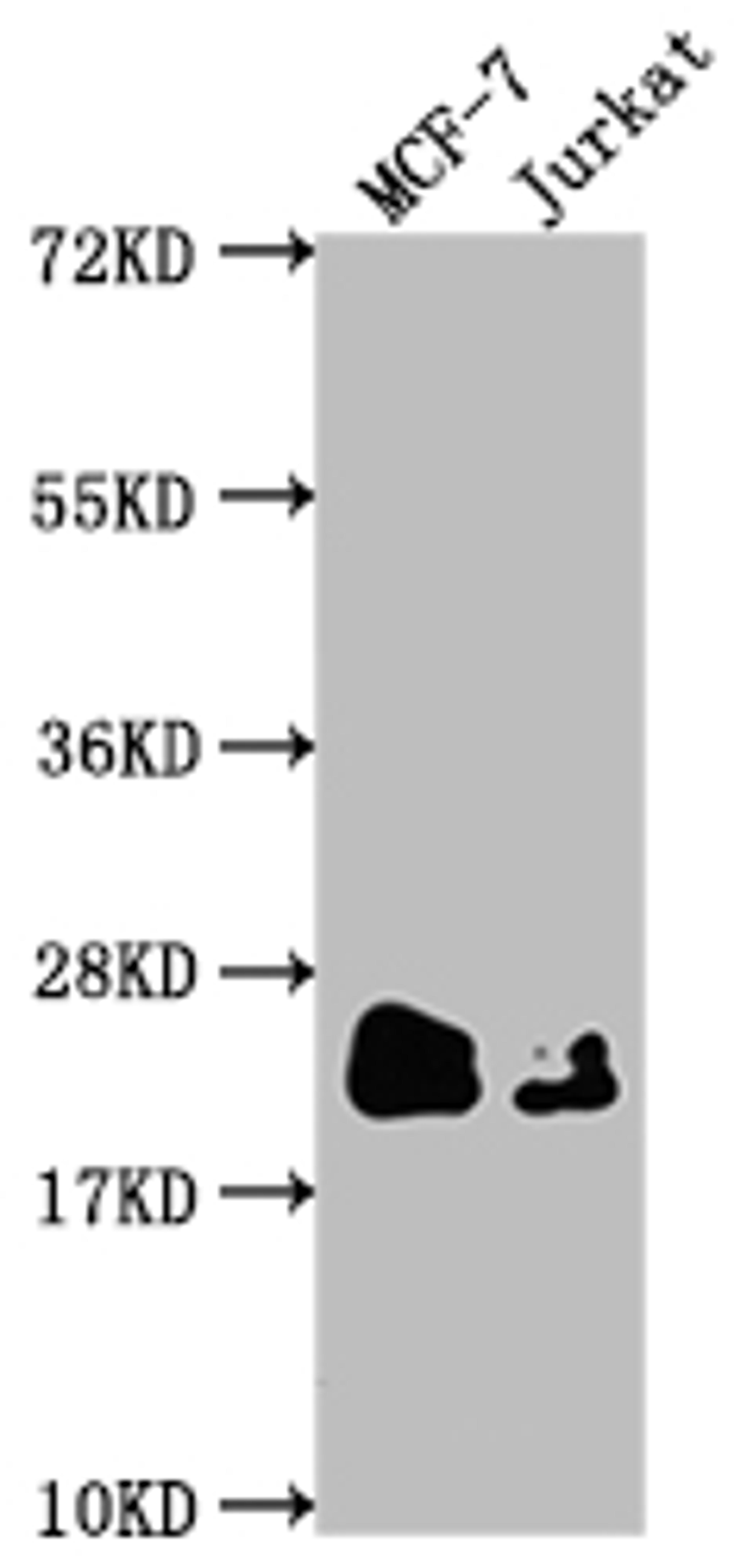 Western Blot. Positive WB detected in: MCF-7 whole cell lysate, Jurkat whole cell lysate. All lanes: MGMT antibody at 1:1500. Secondary. Goat polyclonal to rabbit IgG at 1/50000 dilution. Predicted band size: 22 kDa. Observed band size: 22 kDa. 
