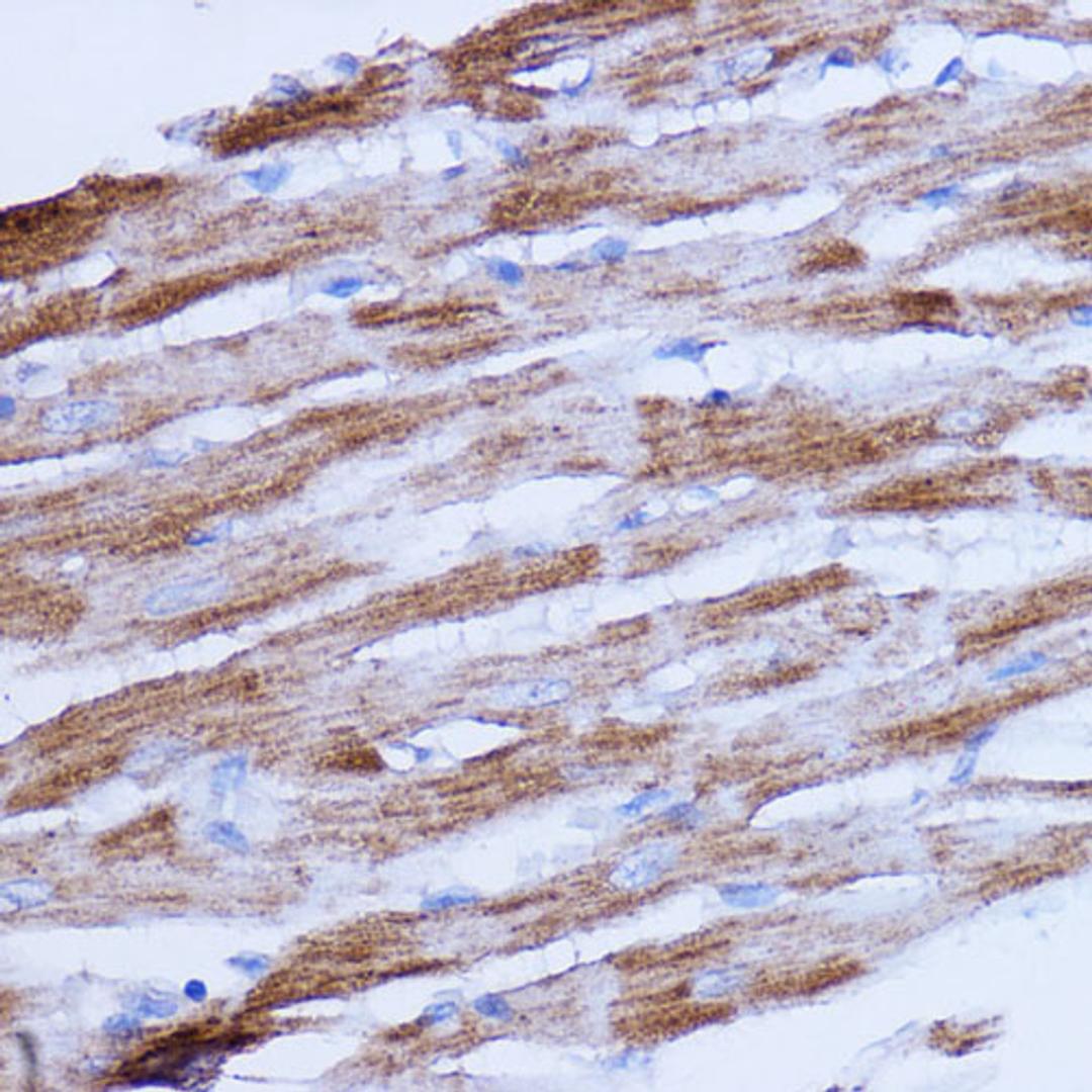 Immunohistochemistry  - NDUFB9 antibody (A17454)