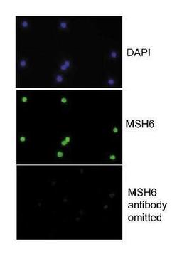 Immunohistochemistry: MSH6 Antibody [NB100-328] - Detection of human MSH6 by Immunocytochemistry, using NB100-328. Sample: HCT116 3-6 cells.