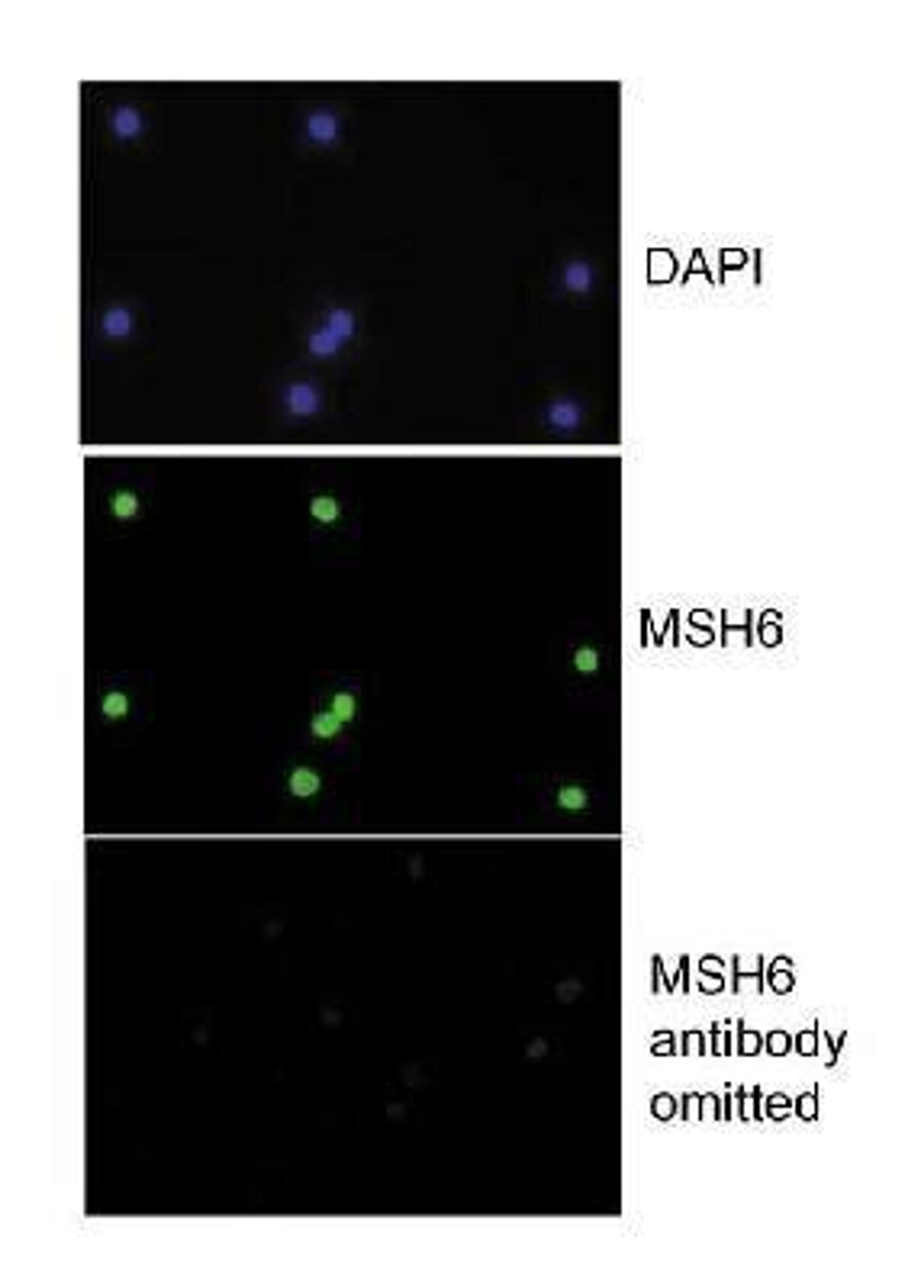 Immunohistochemistry: MSH6 Antibody [NB100-328] - Detection of human MSH6 by Immunocytochemistry, using NB100-328. Sample: HCT116 3-6 cells.