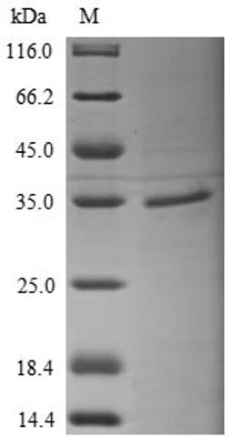 (Tris-Glycine gel) Discontinuous SDS-PAGE (reduced) with 5% enrichment gel and 15% separation gel.