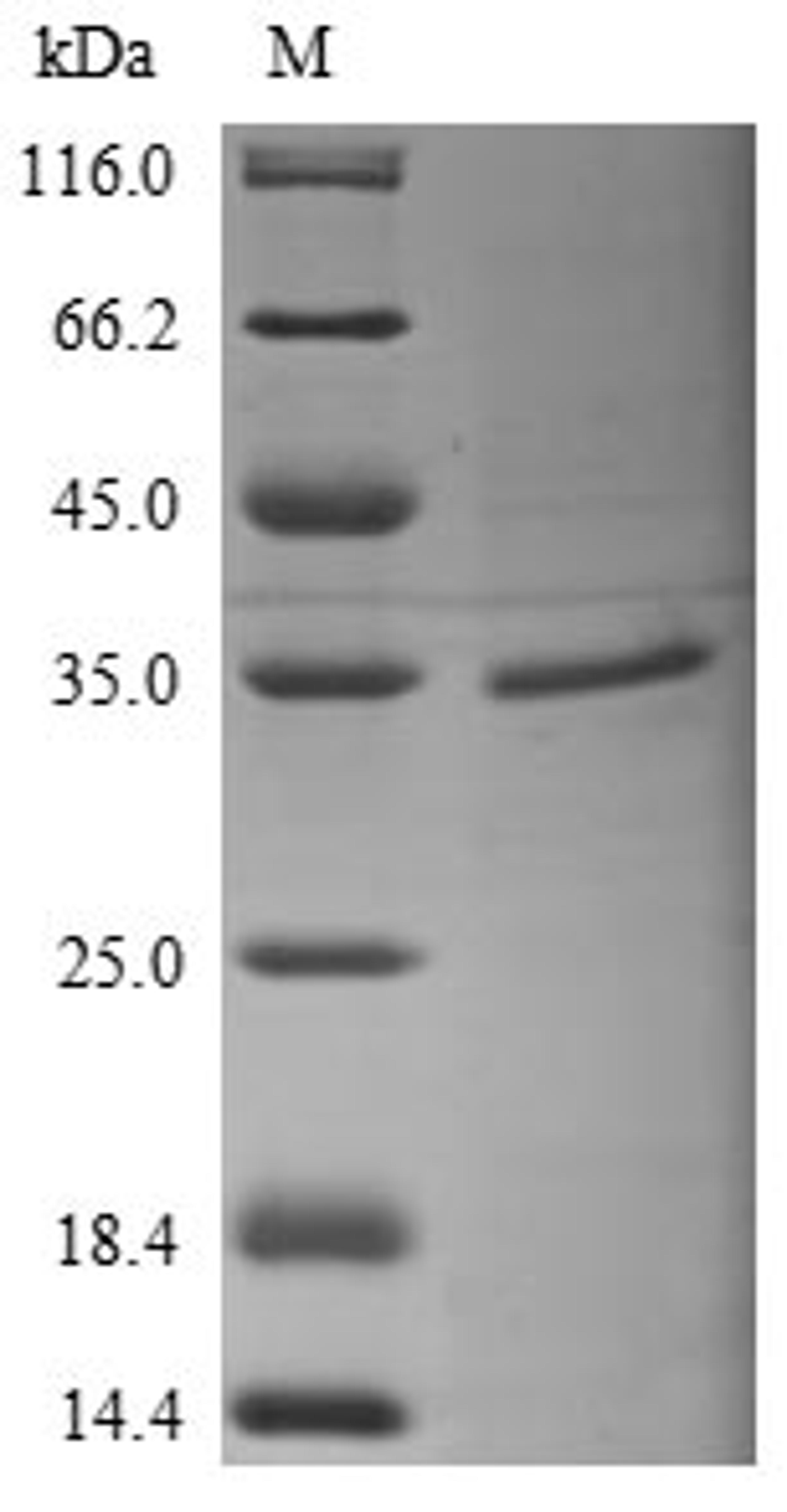 (Tris-Glycine gel) Discontinuous SDS-PAGE (reduced) with 5% enrichment gel and 15% separation gel.