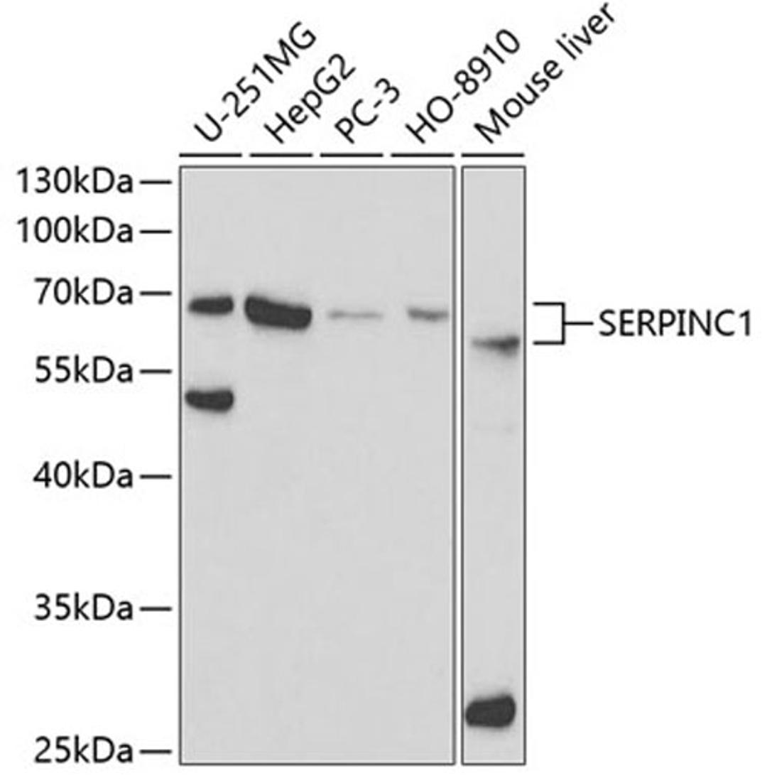 Western blot - SERPINC1 antibody (A1574)