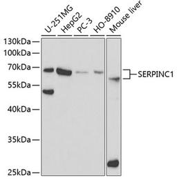 Western blot - SERPINC1 antibody (A1574)