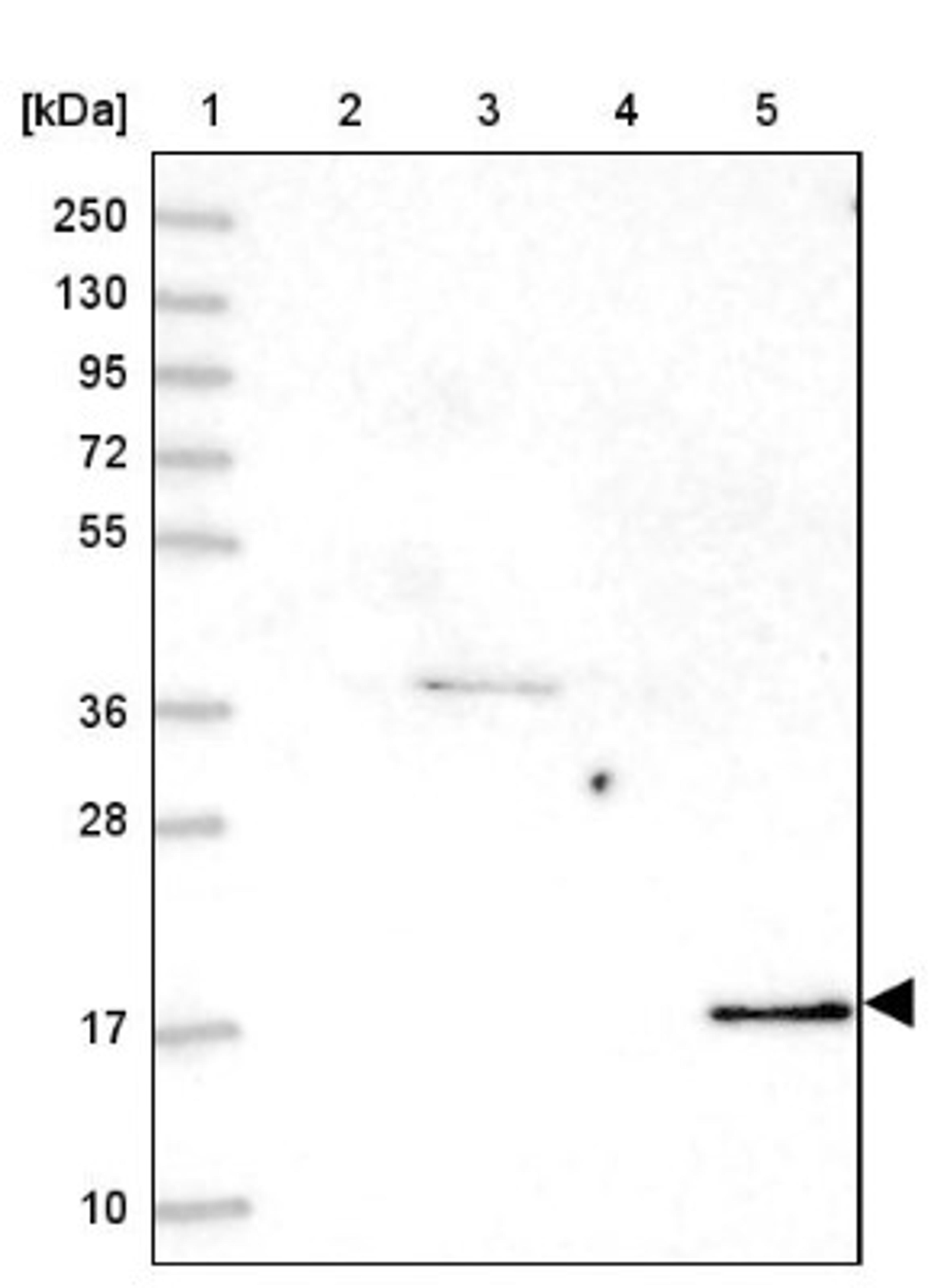 Western Blot: Cofilin 2 Antibody [NBP2-38544] - Lane 1: Marker [kDa] 250, 130, 95, 72, 55, 36, 28, 17, 10<br/>Lane 2: RT-4<br/>Lane 3: U-251 MG<br/>Lane 4: Human Plasma<br/>Lane 5: Liver