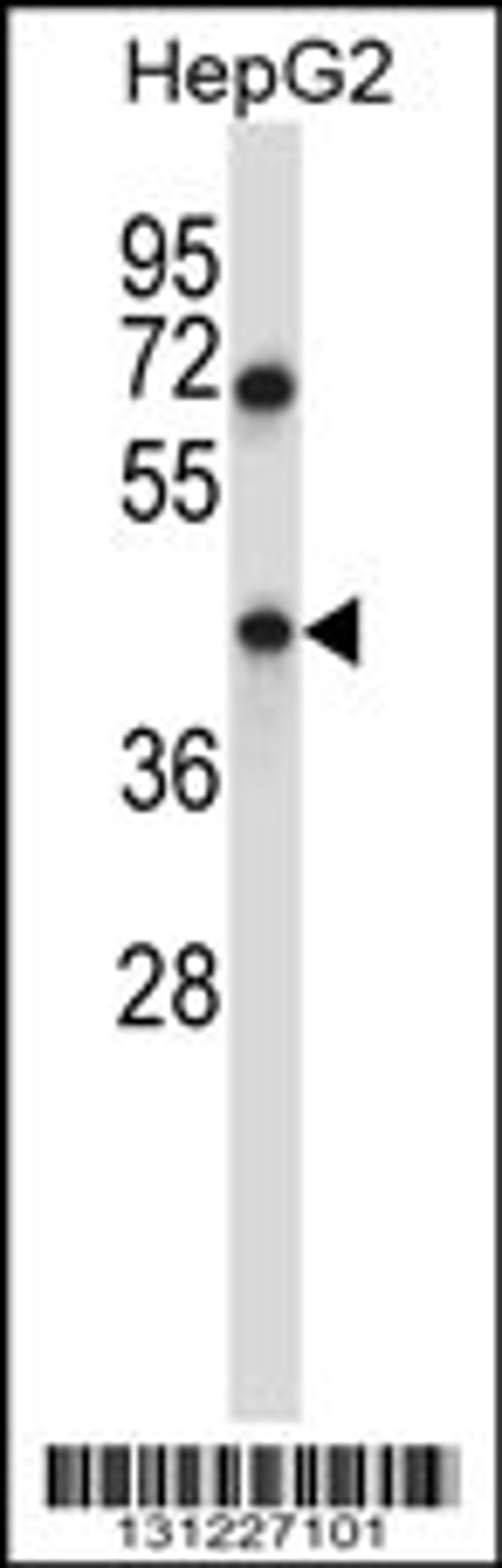 Western blot analysis in HepG2 cell line lysates (35ug/lane).