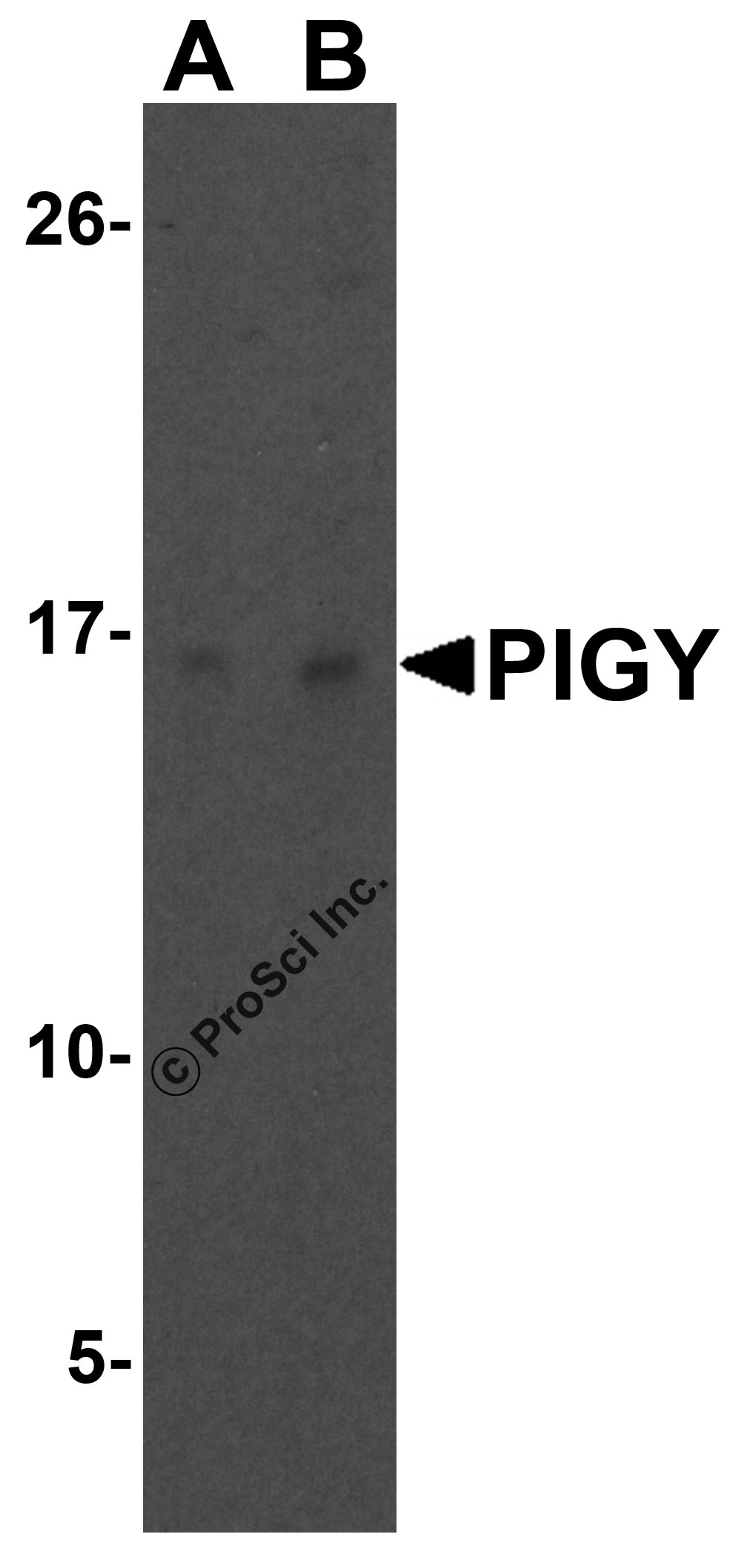 Western blot analysis of PIG-Y in human liver tissue lysate with PIG-Y antibody at (A) 1 and (B) 2 μg/mL.