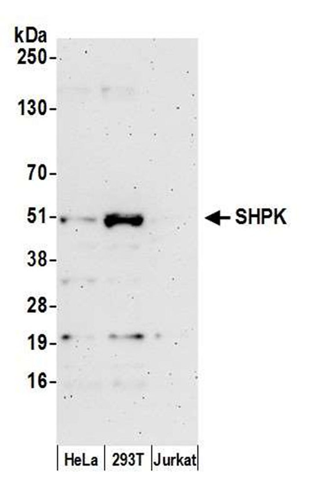 Detection of human SHPK by WB.