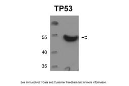 Antibody used in WB on Human DU145 cells at 0.5 ug/ml.