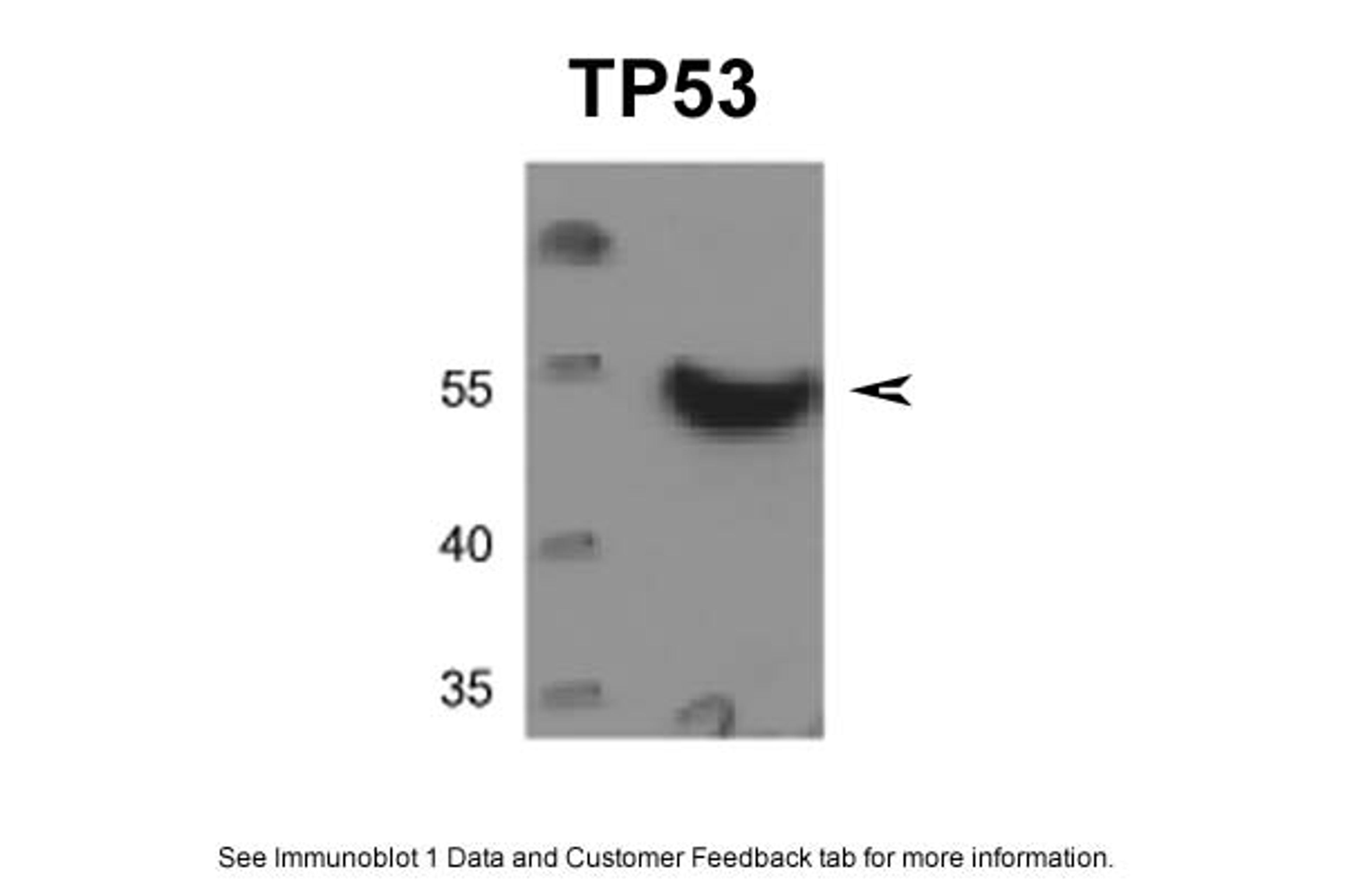 Antibody used in WB on Human DU145 cells at 0.5 ug/ml.