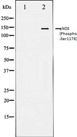 Western blot analysis of HeLa whole cell lysates using eNOS (Phospho-Ser1176) antibody, The lane on the left is treated with the antigen-specific peptide.