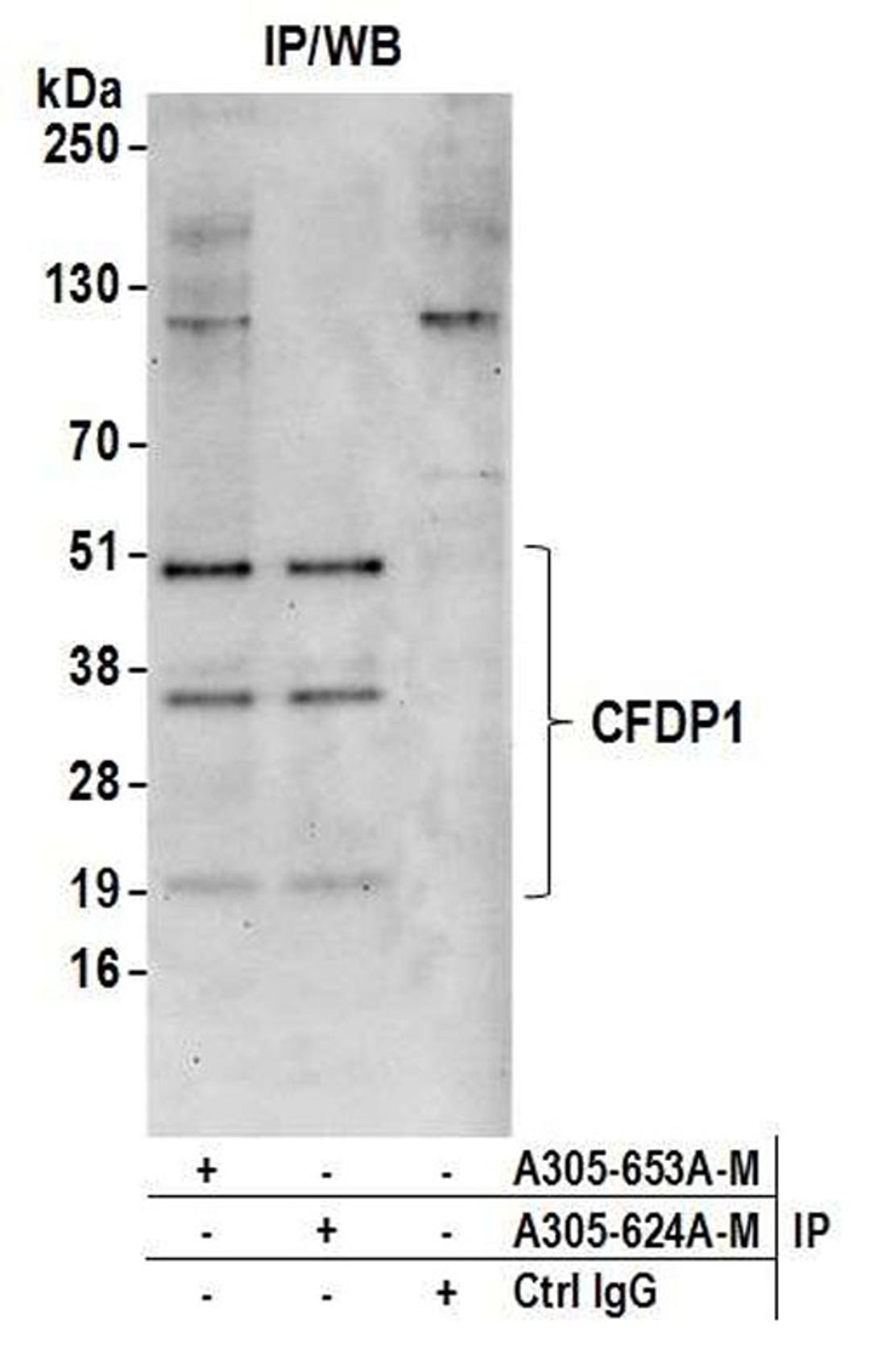 Detection of human CFDP1 by WB of IP.