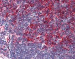 Immunohistochemistry staining of B2M in thymus tissue using B2M Monoclonal Antibody.