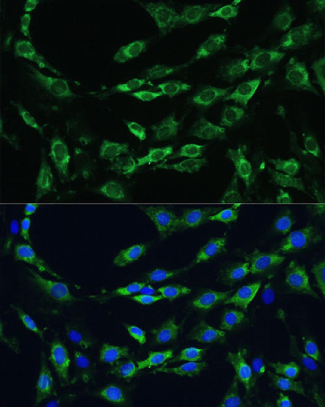 Immunofluorescence - APOB antibody (A1330)