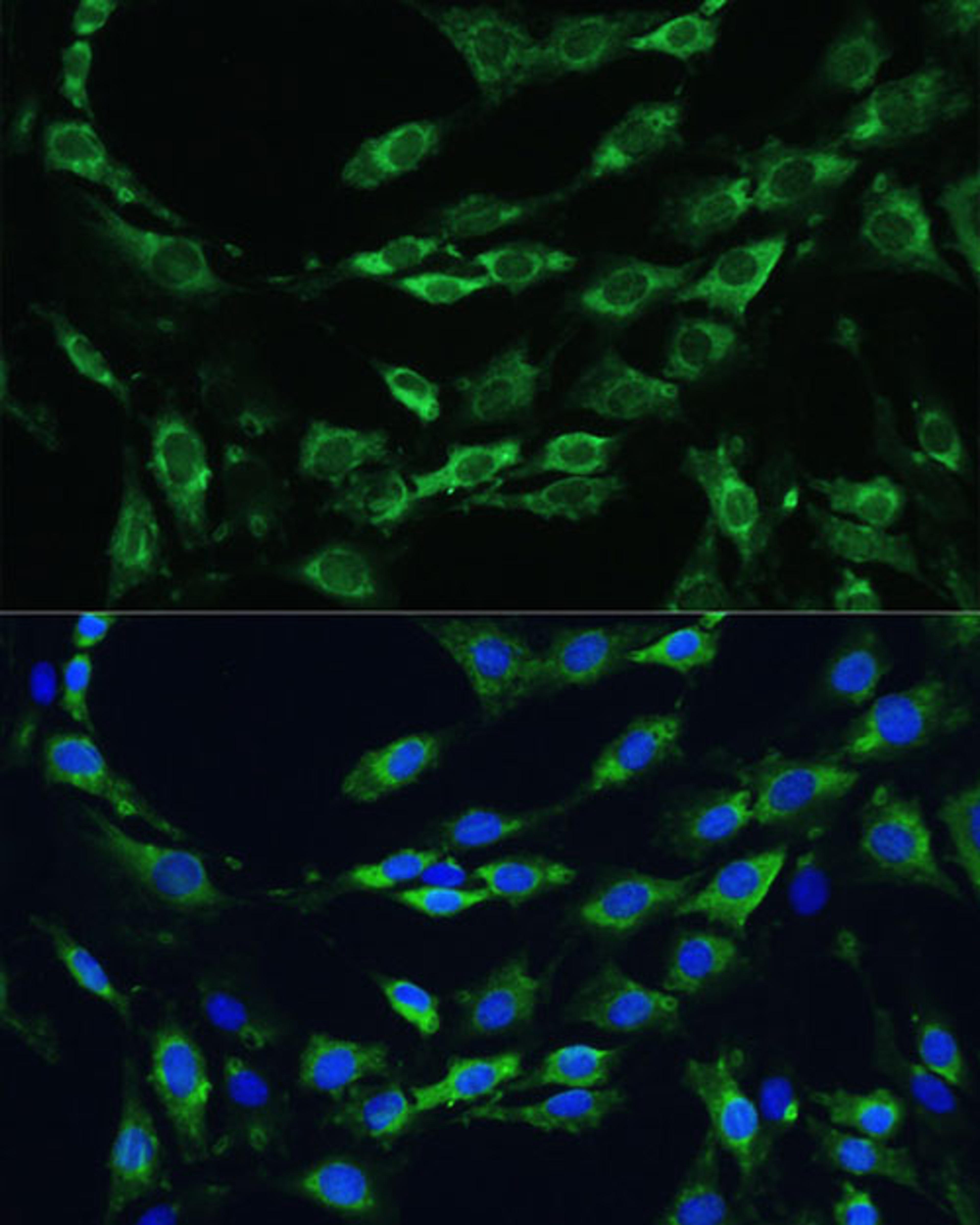 Immunofluorescence - APOB antibody (A1330)