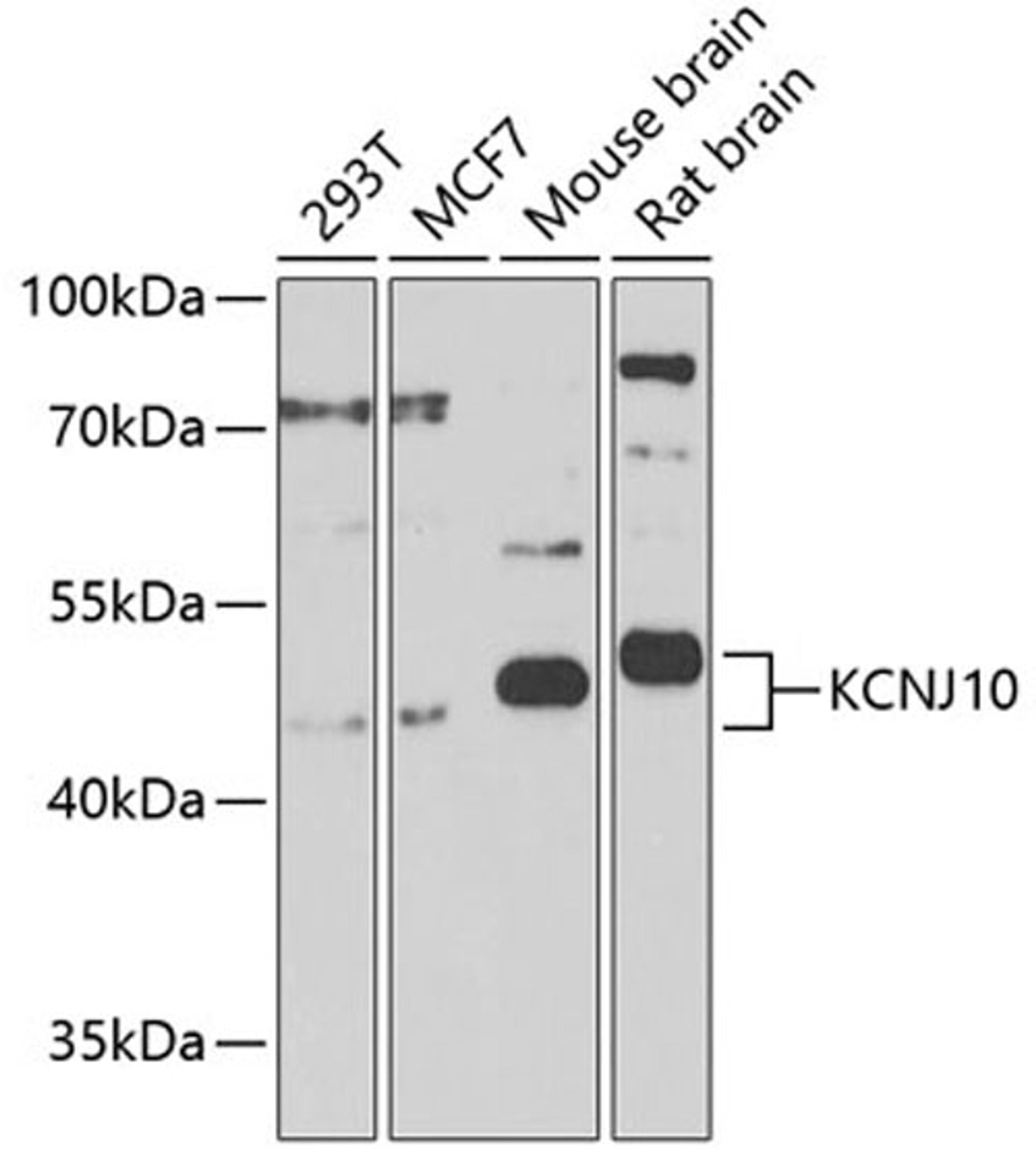 Western blot - KCNJ10 Antibody (A9826)