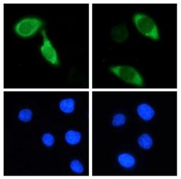 Immunocytochemistry/Immunofluorescence: Cas9 Antibody (7A9-3A3) [NBP2-36440] - Hela cells were transiently transfected with an N-terminally Flag-tagged S. pyogenes Cas9 expression vector.  The cells were stained with the Cas9 antibody followed by anti mouse-AF488 coupled secondary antibody.  Nuclei were counter-stained with Hoechst 33342.