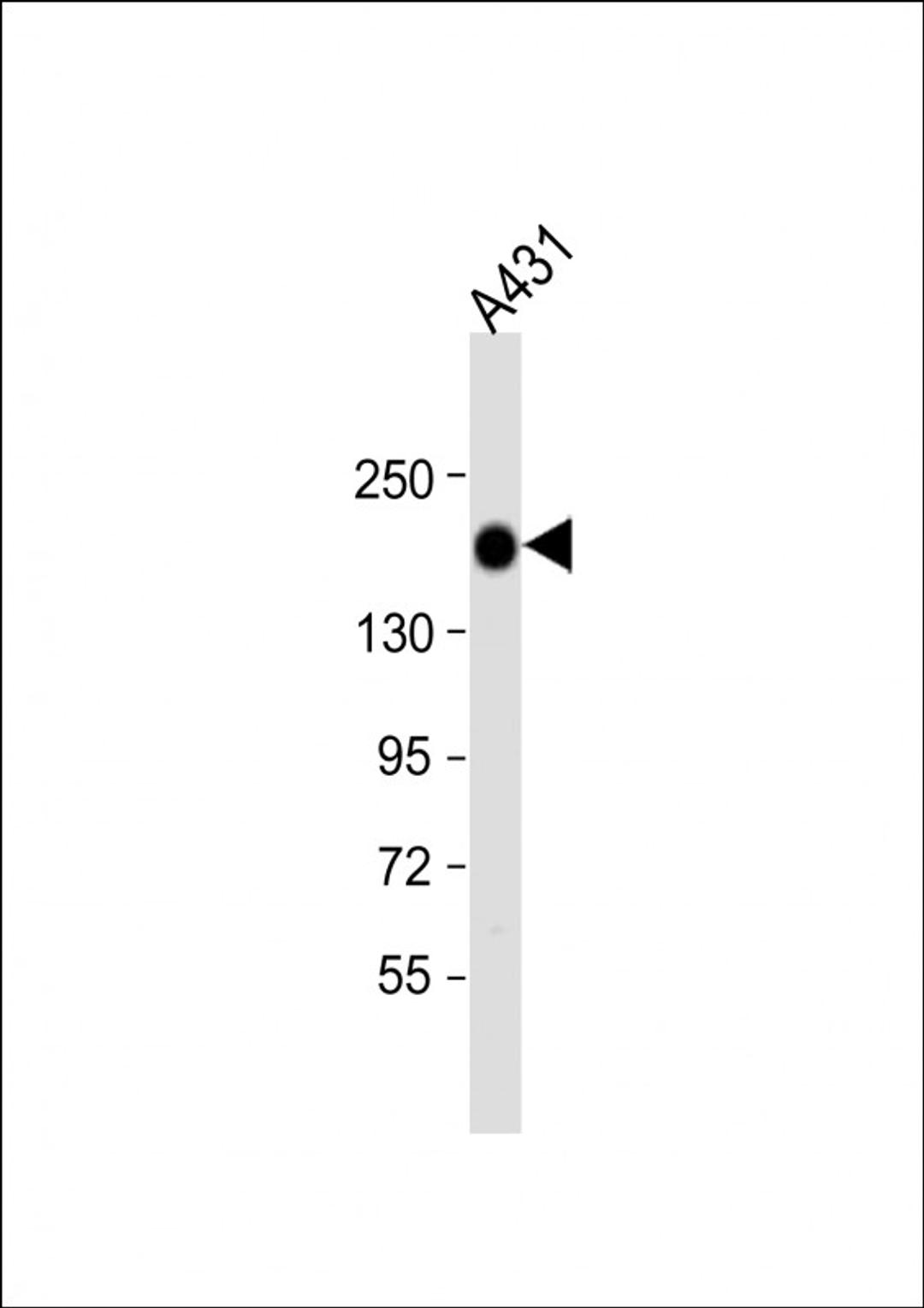 Western Blot at 1:1000 dilution + A431 whole cell lysate Lysates/proteins at 20 ug per lane.