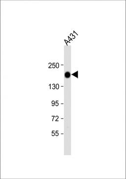 Western Blot at 1:1000 dilution + A431 whole cell lysate Lysates/proteins at 20 ug per lane.