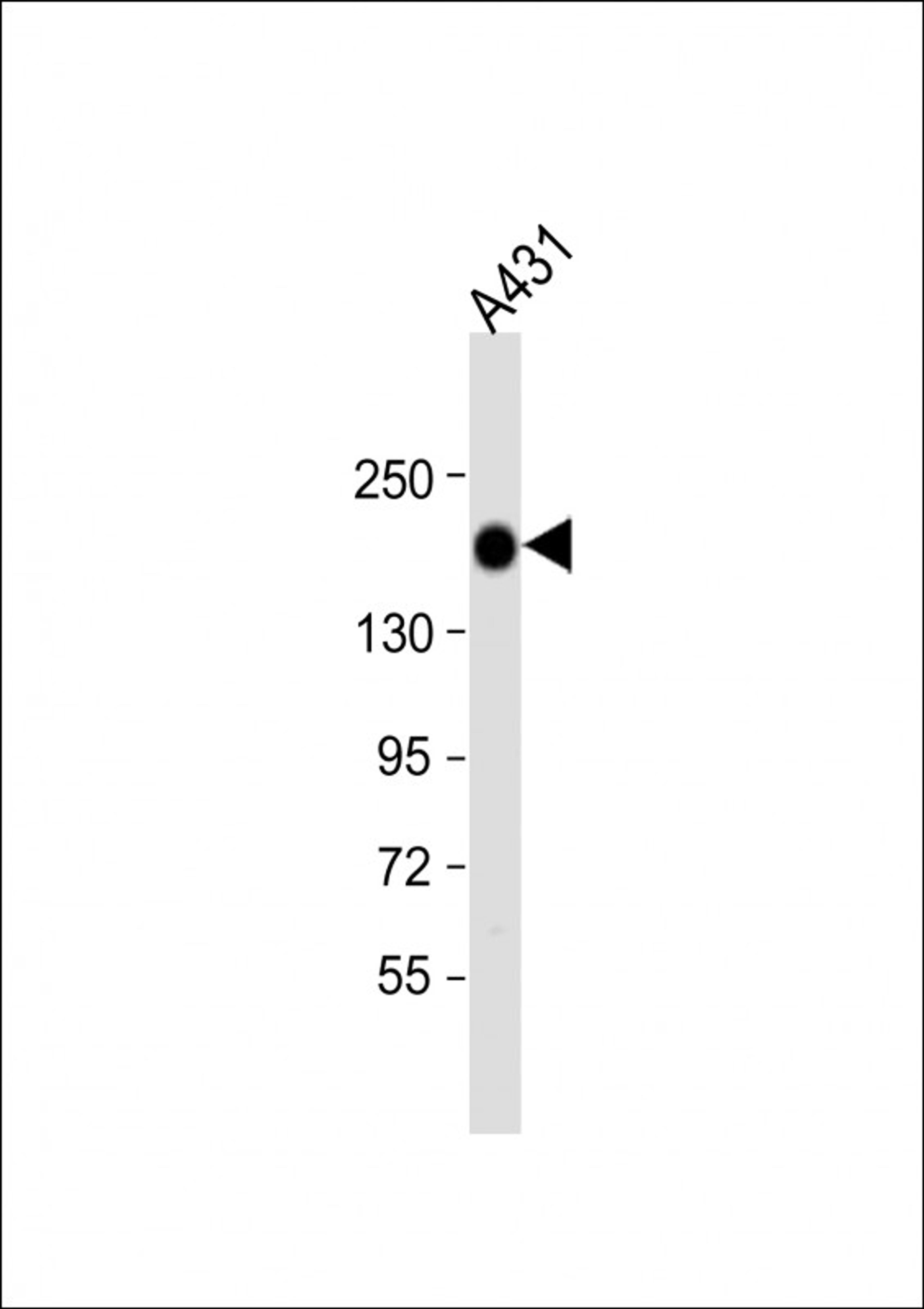 Western Blot at 1:1000 dilution + A431 whole cell lysate Lysates/proteins at 20 ug per lane.