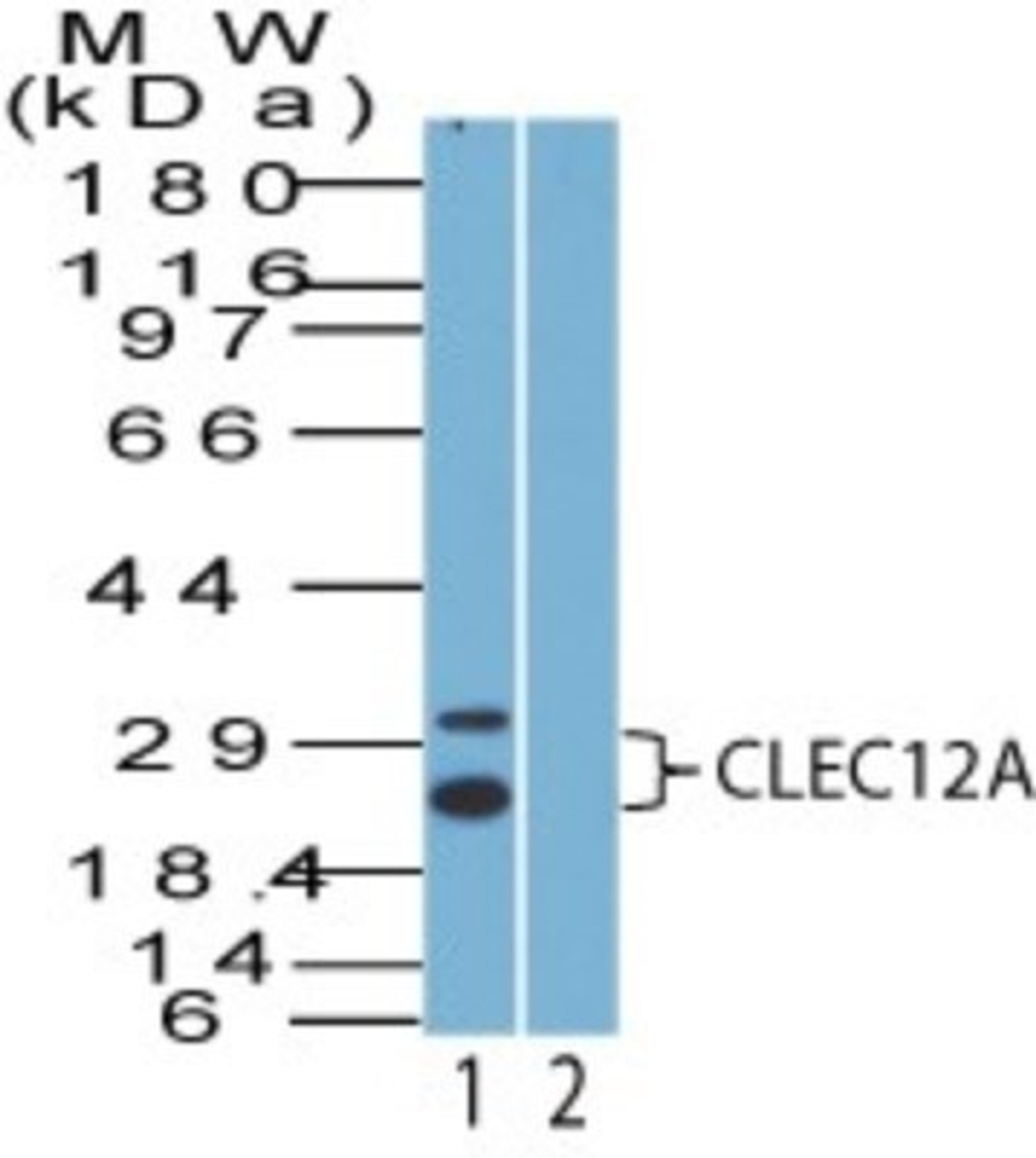 Western Blot: CLEC12A Antibody [NBP2-27346] - Analysis of CLEC12A using CLEC12A antibody. ThP1 cell lysate in the 1) absence and 2) presence of immunizing peptide probed with 2 ug/ml of CLEC12A antibody. I goat anti-rabbit Ig HRP secondary antibody and PicoTect ECL substrate solution were used for this test.