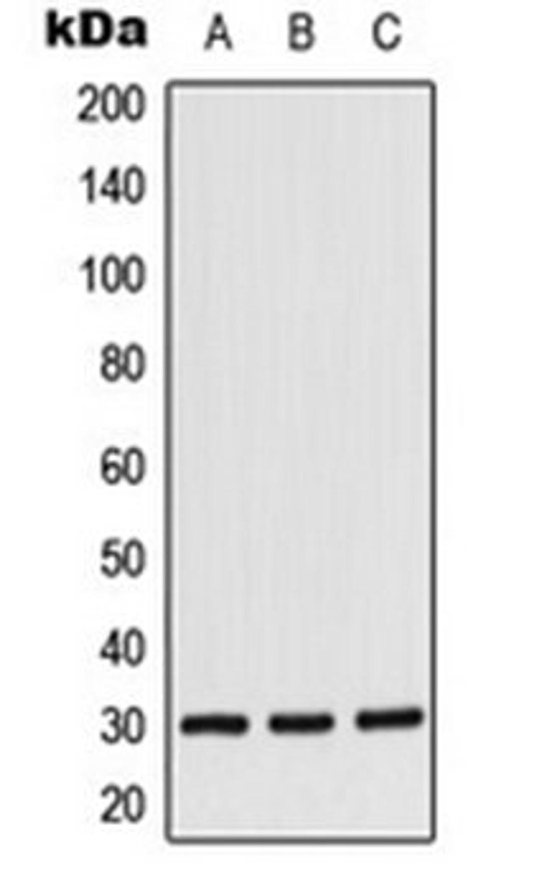 Western blot analysis of Jurkat (Lane 1), K562 (Lane 2), NIH3T3 (Lane 3) whole cell lysates using CK1 alpha antibody