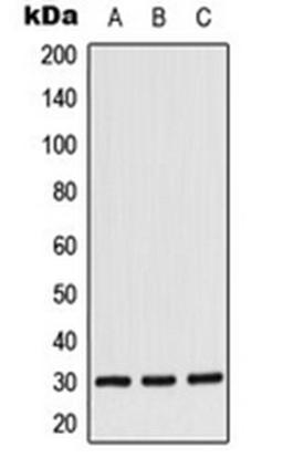 Western blot analysis of Jurkat (Lane 1), K562 (Lane 2), NIH3T3 (Lane 3) whole cell lysates using CK1 alpha antibody