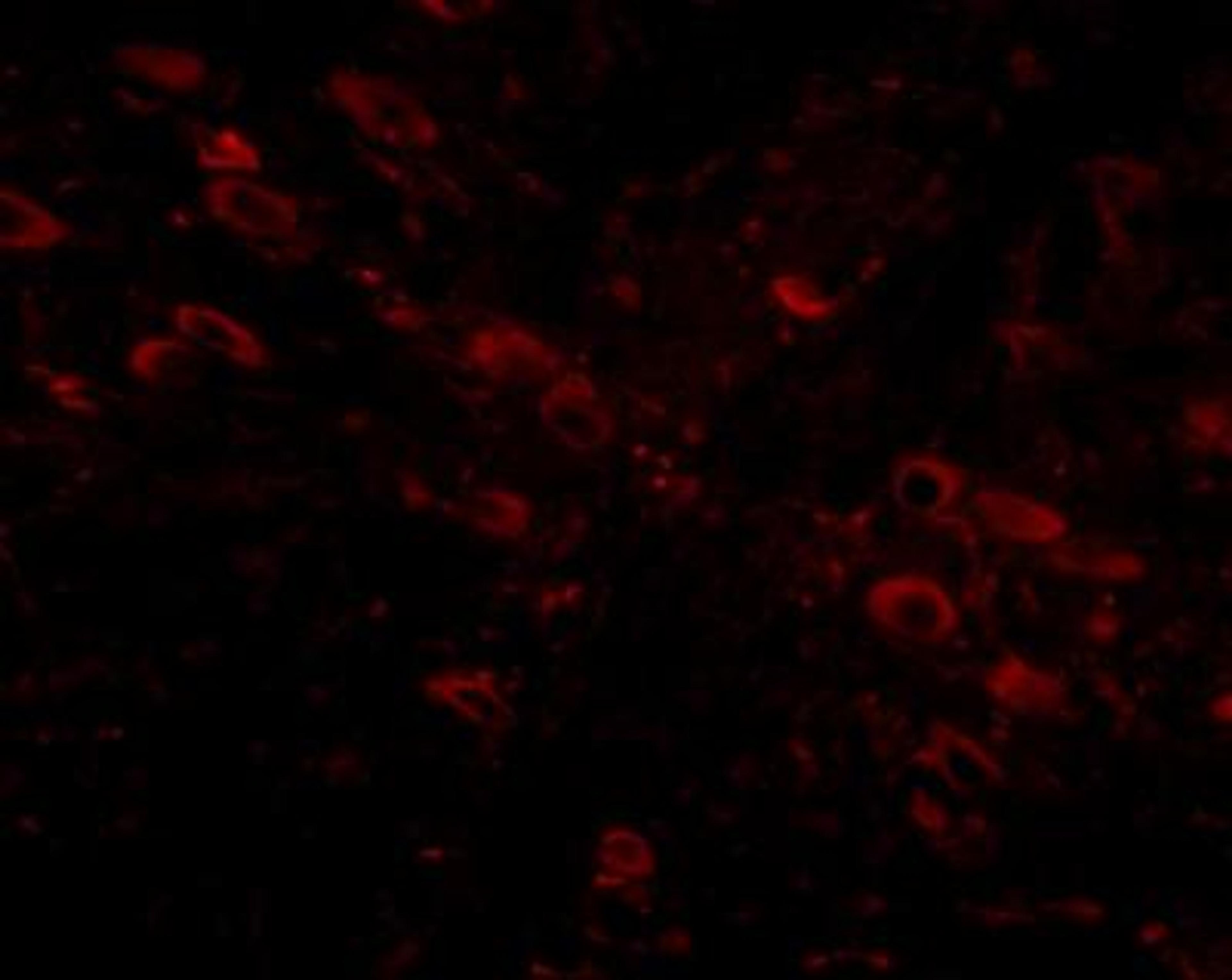 Immunocytochemistry/Immunofluorescence: GLE1 Antibody [NBP1-76975] - Immunofluorescence of gle1 in mouse brain tissue with gle1 antibody at 5 ug/mL.