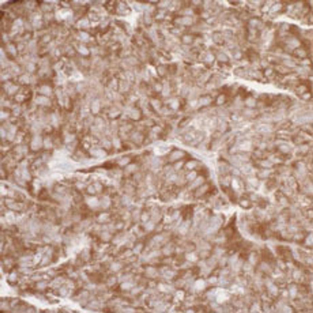 Detection of human RPL7 by immunohistochemistry.