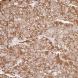 Detection of human RPL7 by immunohistochemistry.