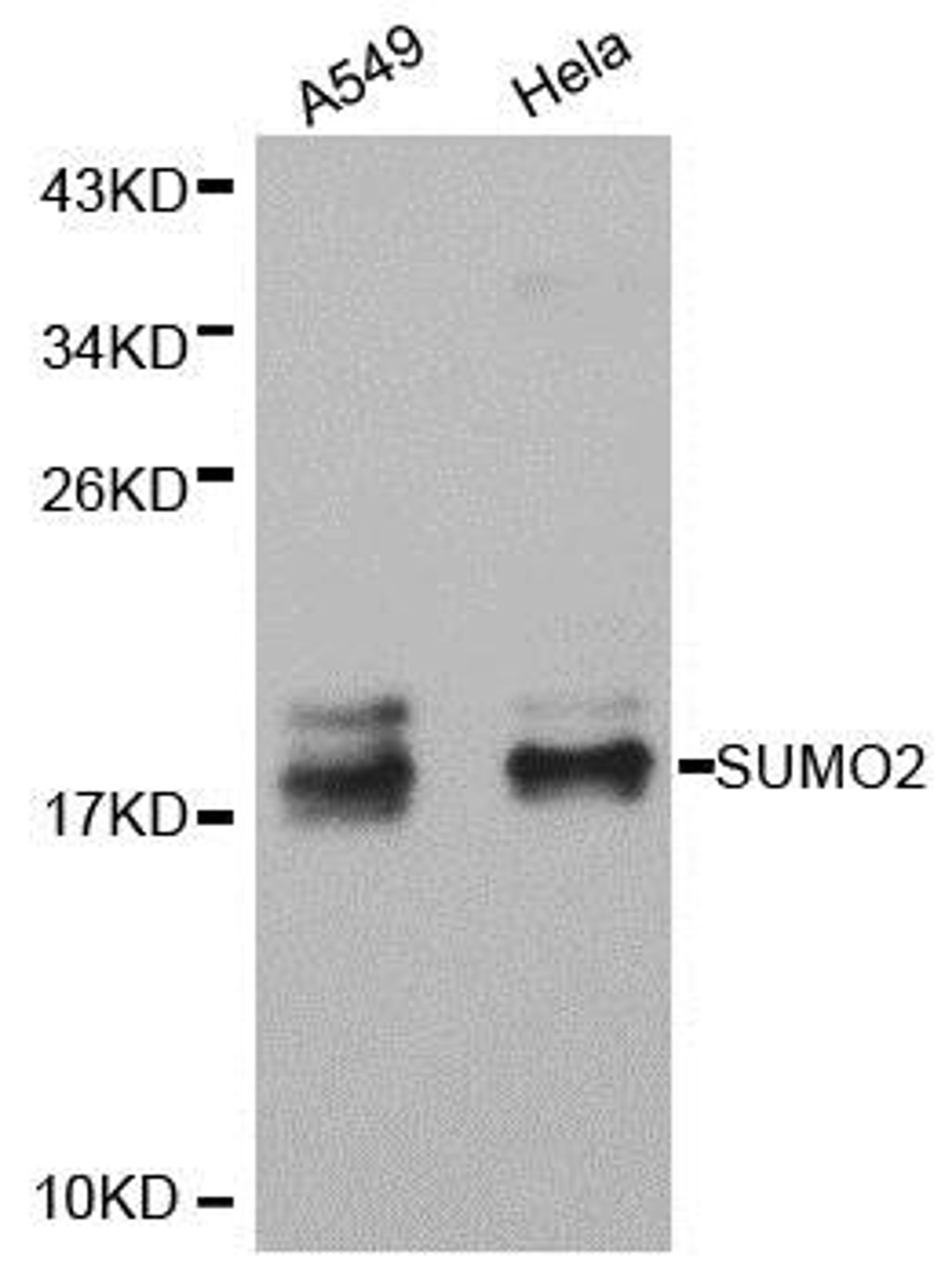 Western blot analysis of extracts of various cell lines using SUMO2 antibody