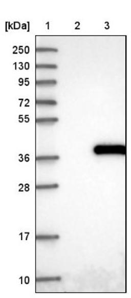 Western Blot: NUDT22 Antibody [NBP1-82754] - Lane 1: Marker [kDa] 250, 130, 95, 72, 55, 36, 28, 17, 10<br/>Lane 2: Negative control (vector only transfected HEK293T lysate)<br/>Lane 3: Over-expression lysate (Co-expressed with a C-terminal myc-DDK tag (~3.1 kDa) in mammalian HEK293T cells, LY410181)