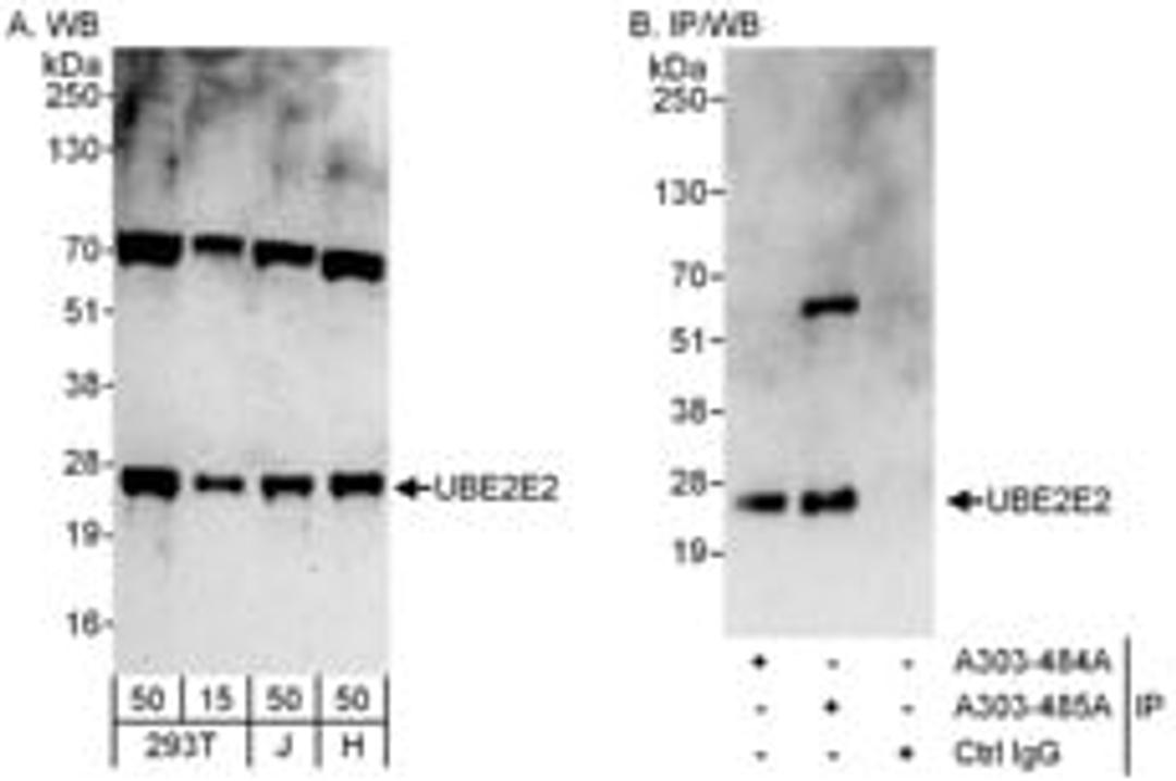 Detection of human UBE2E2 by western blot and immunoprecipitation.