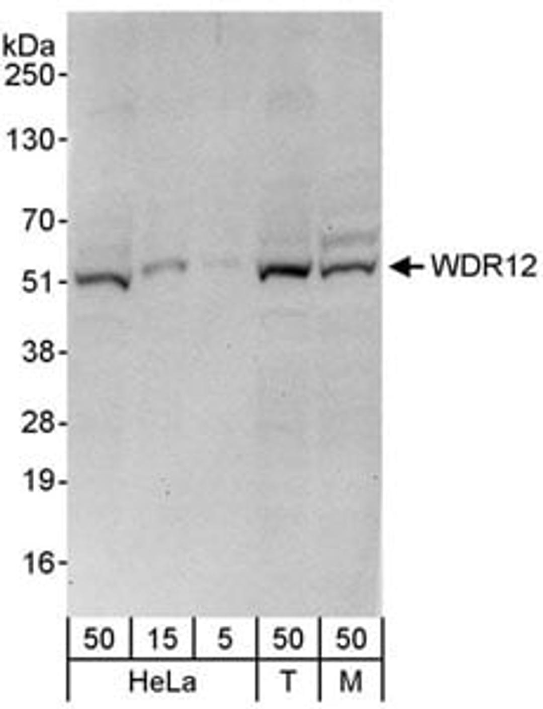 Detection of human and mouse WDR12 by western blot.