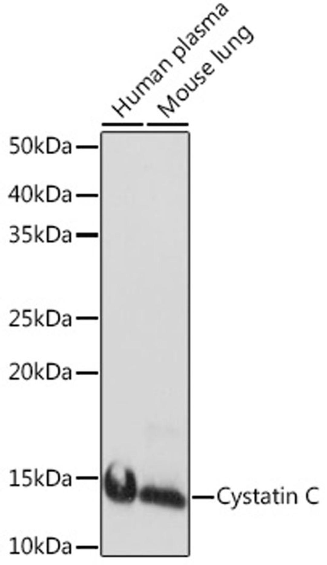 Western blot - Cystatin C Rabbit mAb (A8933)