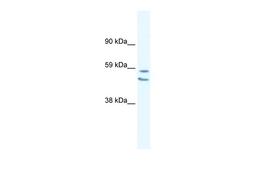 Antibody used in WB on Human Lung at 0.2-1 ug/ml.