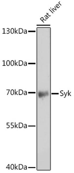 Western blot - Syk antibody (A2123)