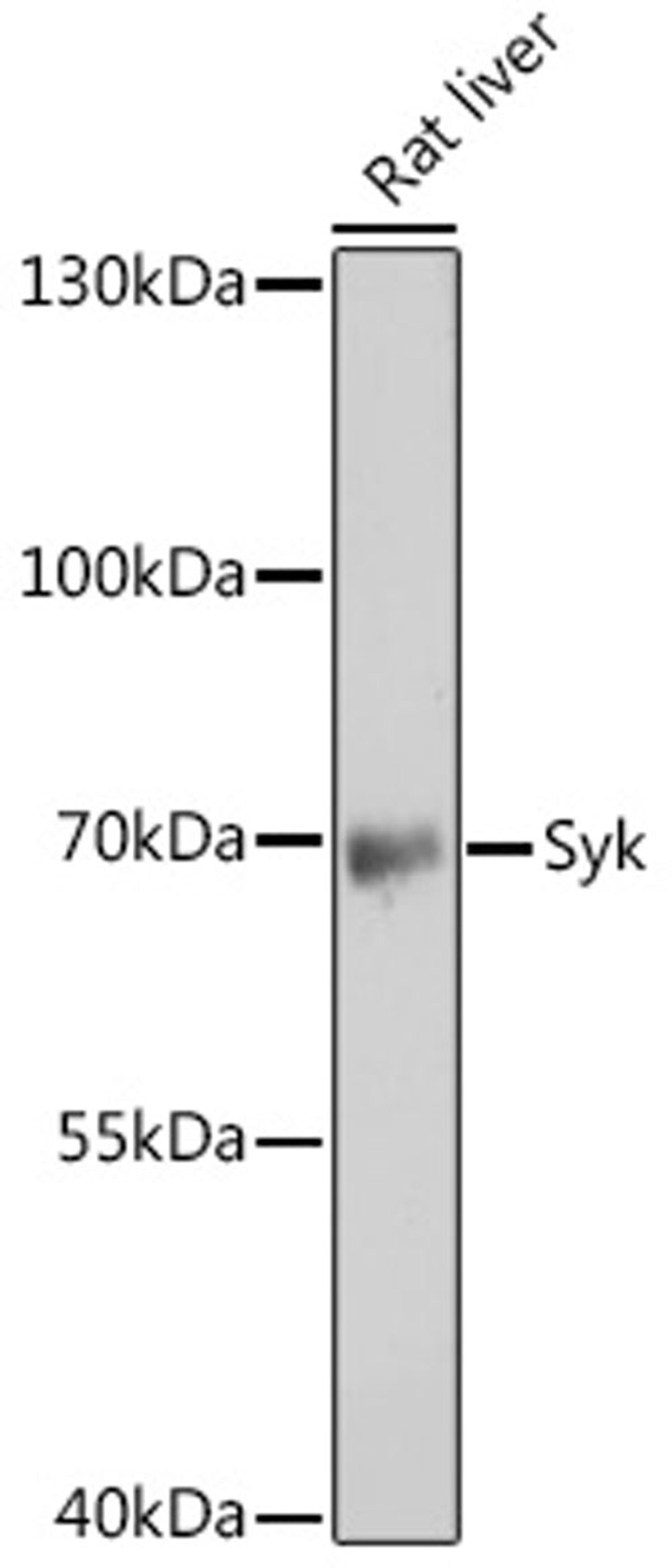 Western blot - Syk antibody (A2123)