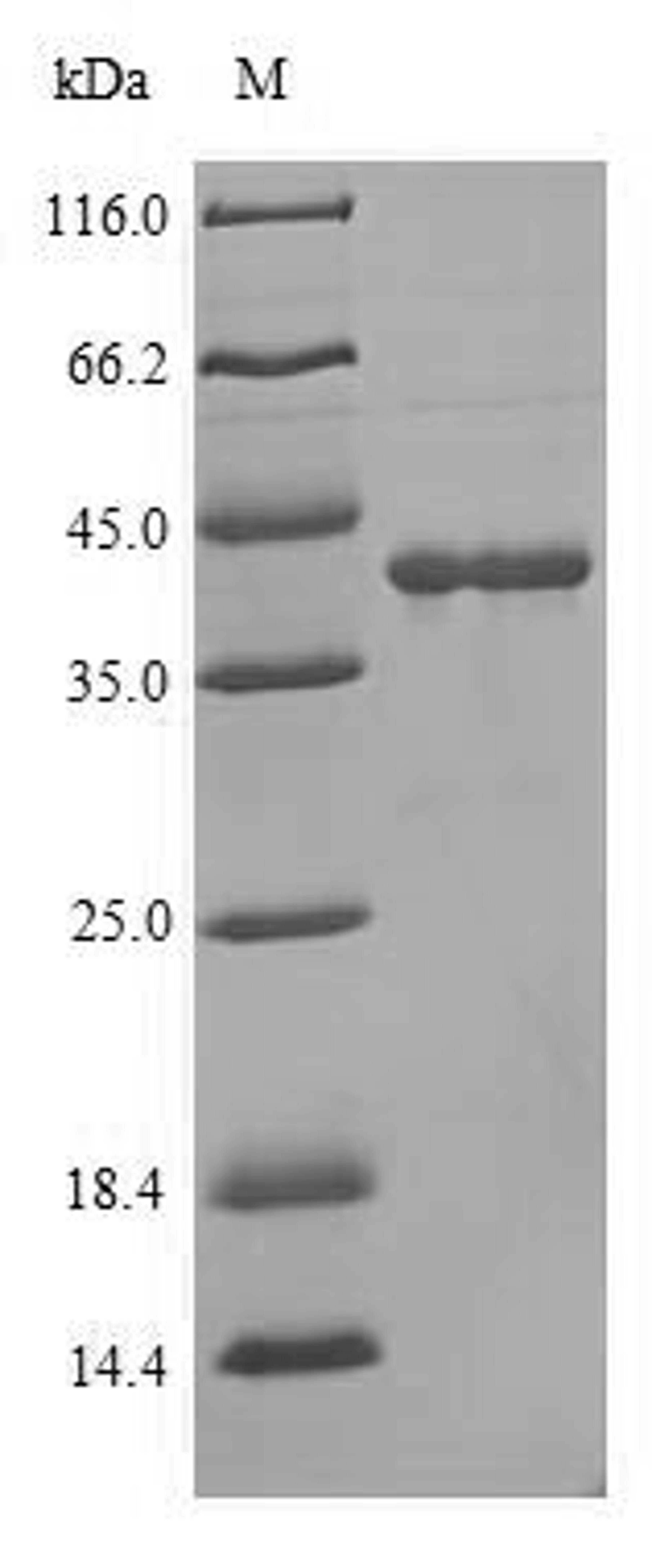 (Tris-Glycine gel) Discontinuous SDS-PAGE (reduced) with 5% enrichment gel and 15% separation gel.