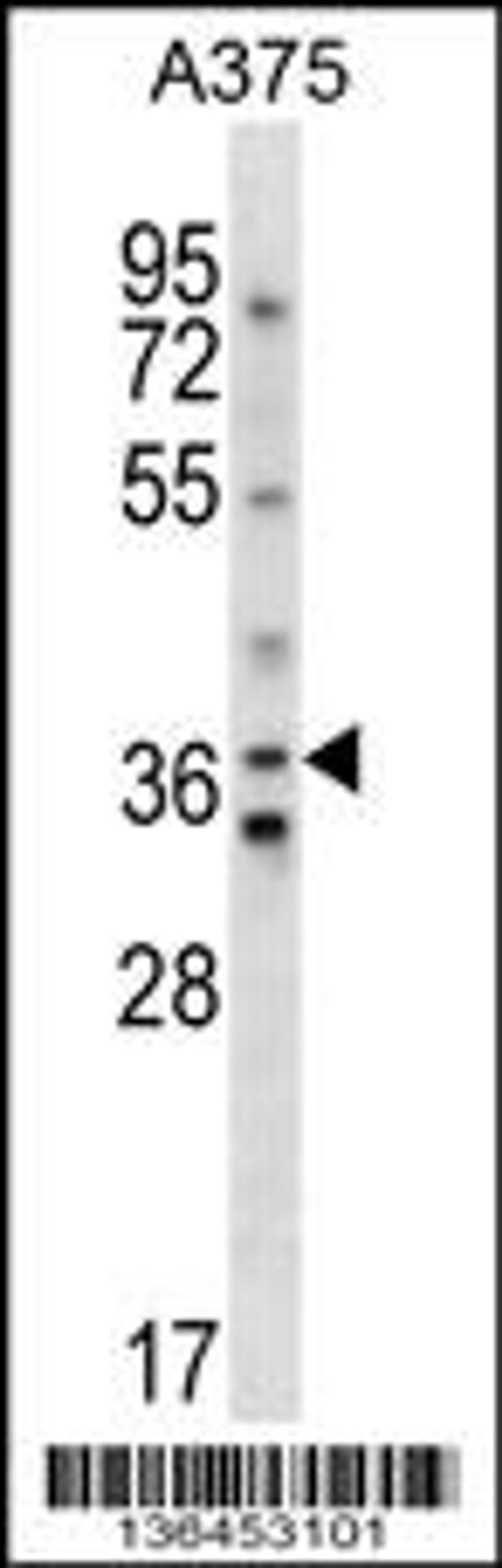 Western blot analysis in A375 cell line lysates (35ug/lane).