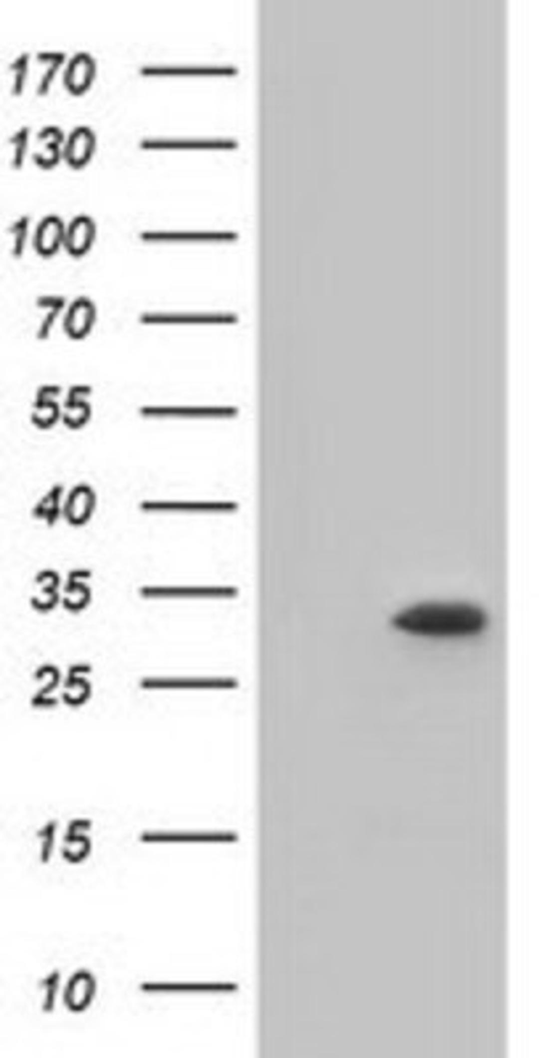 Western Blot: ketohexokinase Antibody (1D8) [NBP2-02639] - HEK293T cells were transfected with the pCMV6-ENTRY control (Left lane) or pCMV6-ENTRY ketohexokinase (Right lane) cDNA for 48 hrs and lysed. Equivalent amounts of cell lysates (5 ug per lane) were separated by SDS-PAGE and immunoblotted with anti-ketohexokinase.