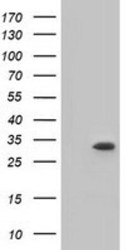 Western Blot: ketohexokinase Antibody (1D8) [NBP2-02639] - HEK293T cells were transfected with the pCMV6-ENTRY control (Left lane) or pCMV6-ENTRY ketohexokinase (Right lane) cDNA for 48 hrs and lysed. Equivalent amounts of cell lysates (5 ug per lane) were separated by SDS-PAGE and immunoblotted with anti-ketohexokinase.