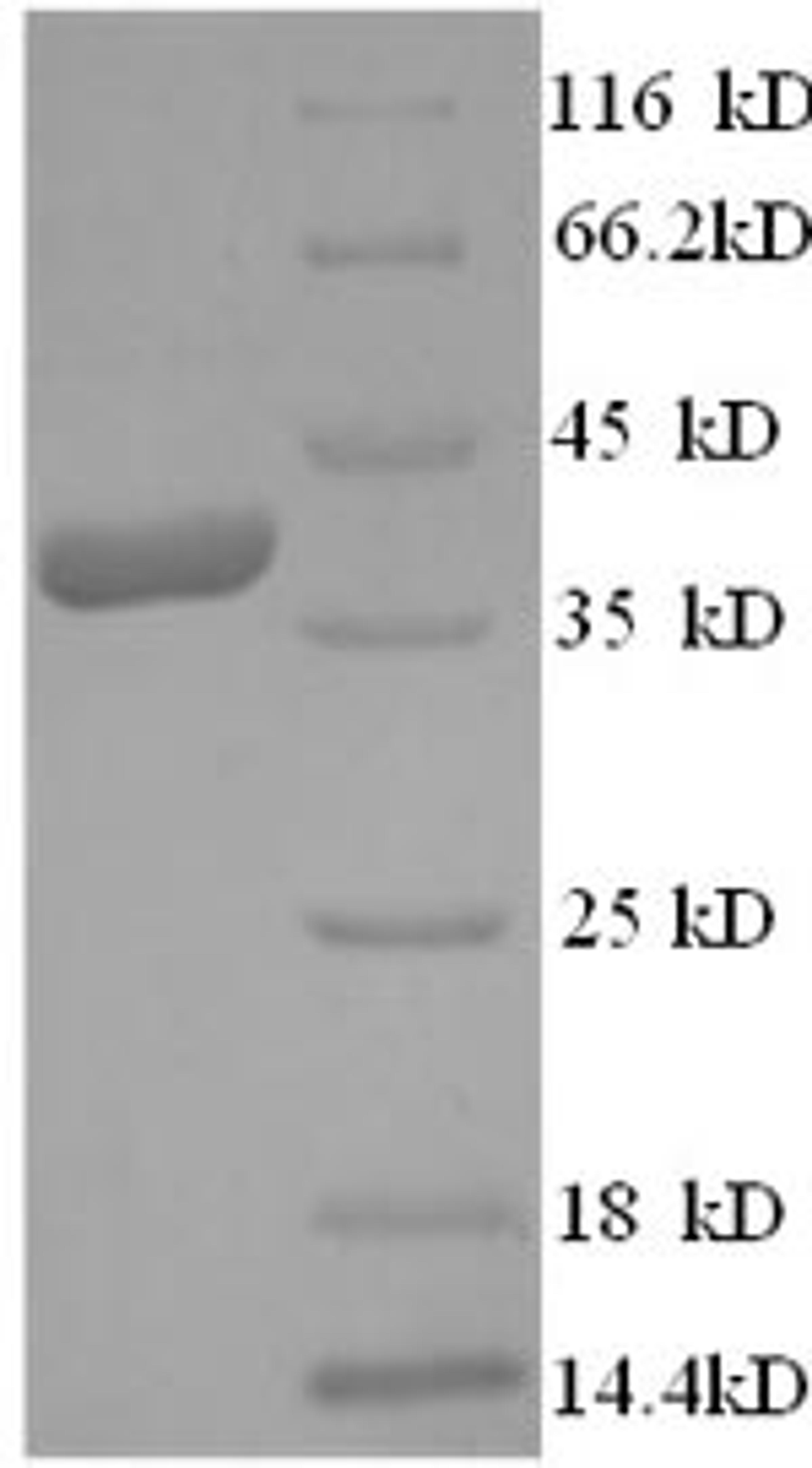 (Tris-Glycine gel) Discontinuous SDS-PAGE (reduced) with 5% enrichment gel and 15% separation gel.