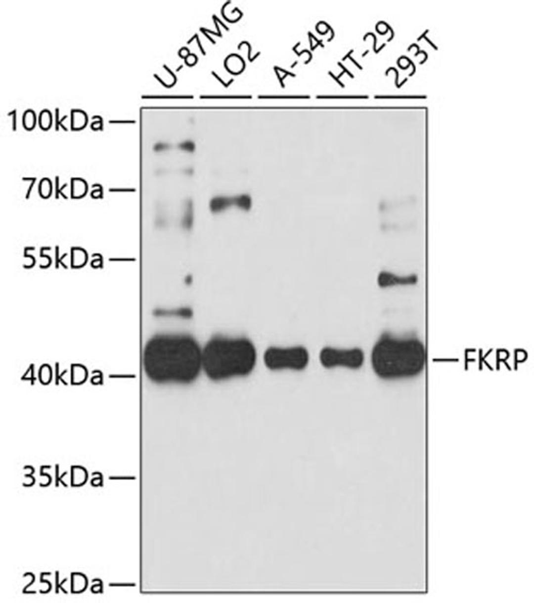 Western blot - FKRP antibody (A10194)