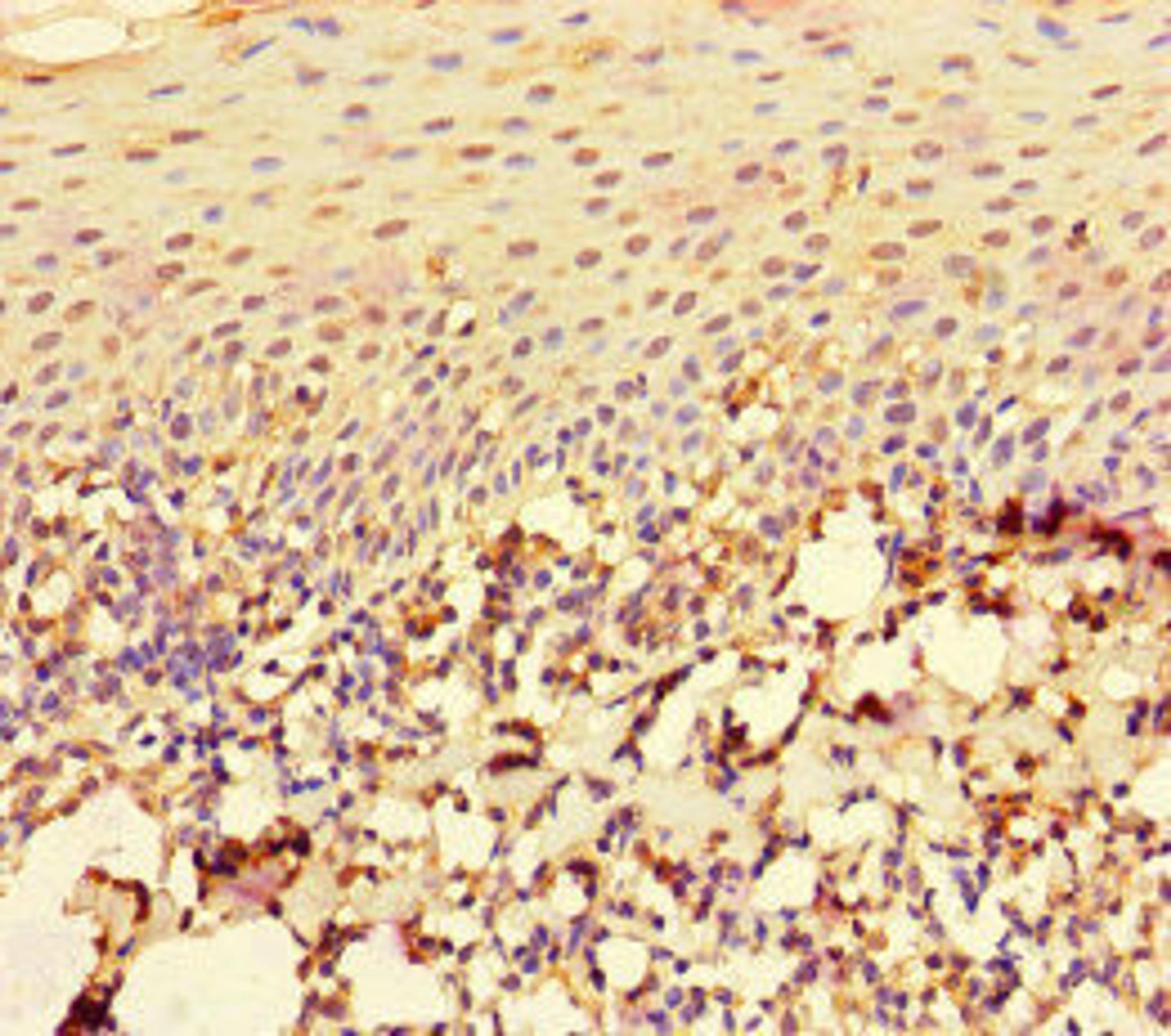 Immunohistochemistry of paraffin-embedded human tonsil tissue using CSB-PA04329A0Rb at dilution of 1:100